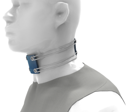 Aplicación cervical de estimulación espinal transcutánea tSDCS