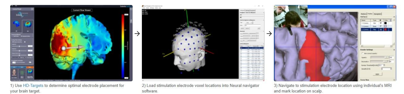 Sistema HD-tES para neuromodulación optimizada