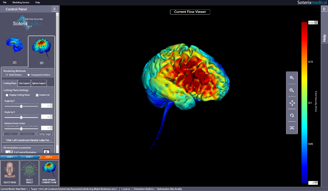 Sistema HD-tES para neuromodulación optimizada